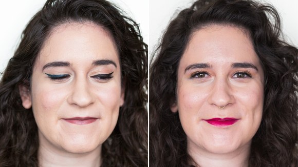 Juvederm Volbella Before and After