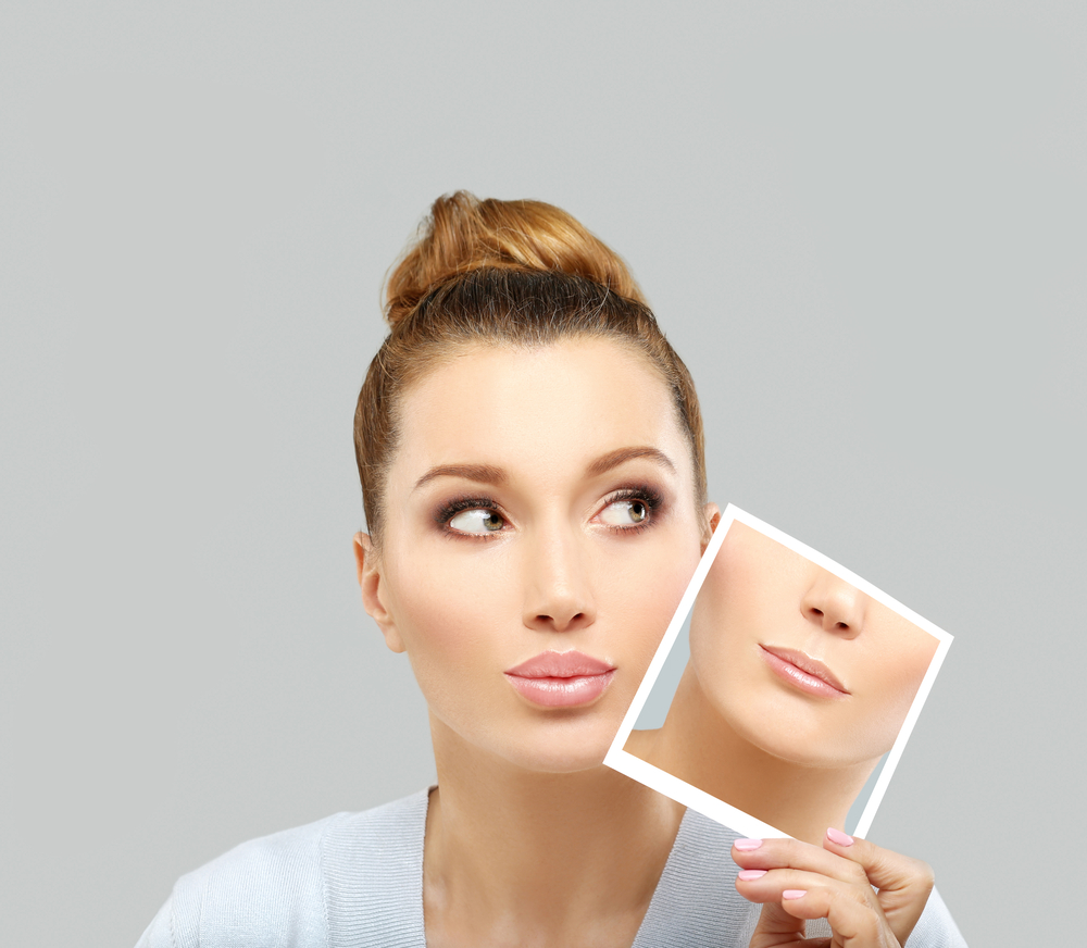 Dermal Fillers