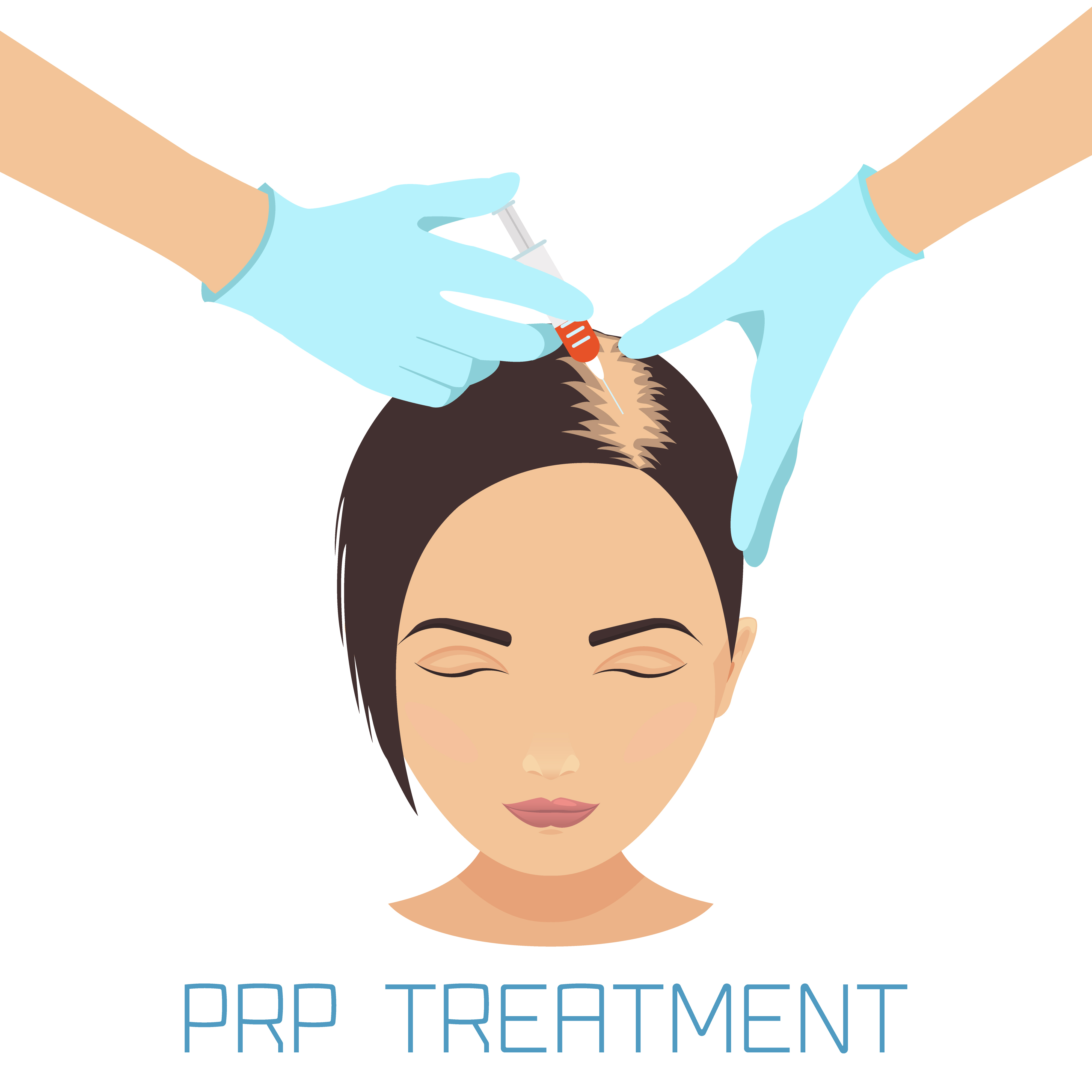 PRP for Hair Loss