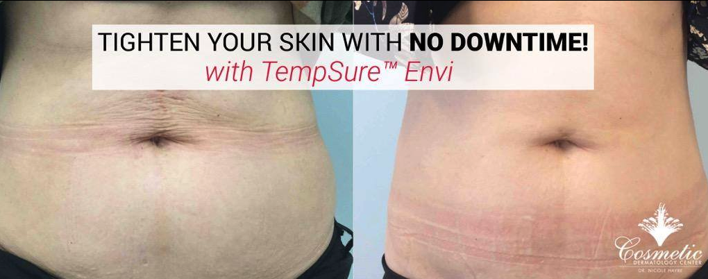 tempsure envi mclean