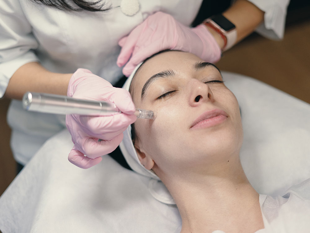 microneedling northern virginia