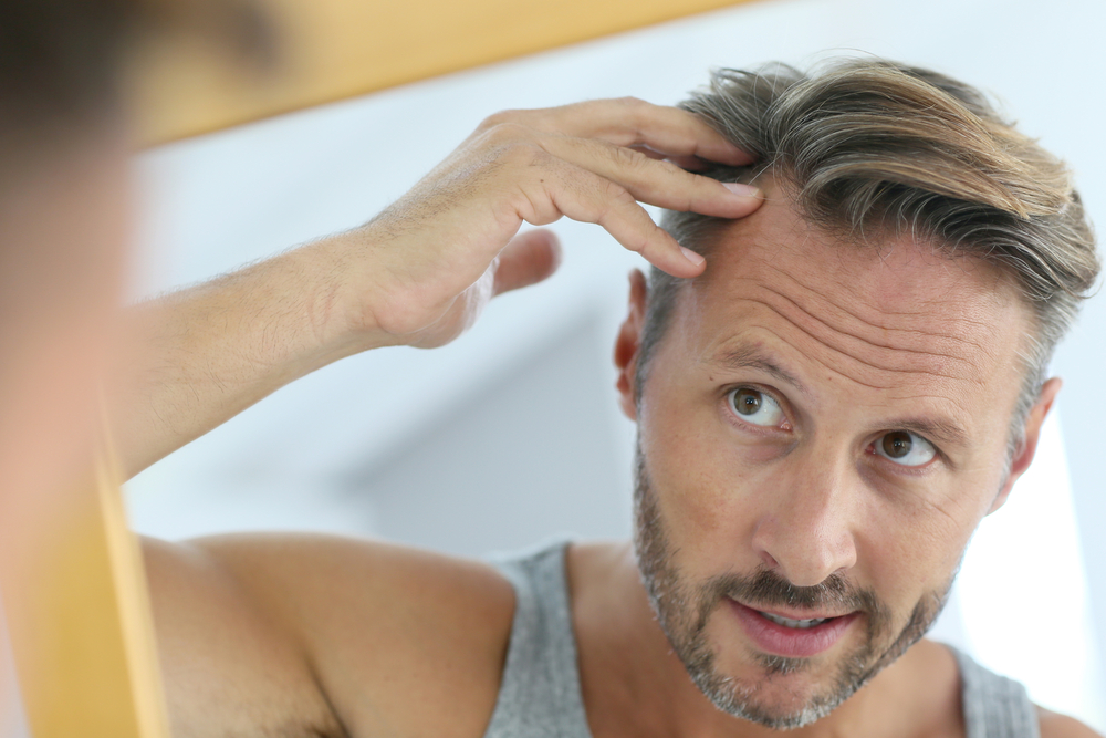 PRP Hair Loss