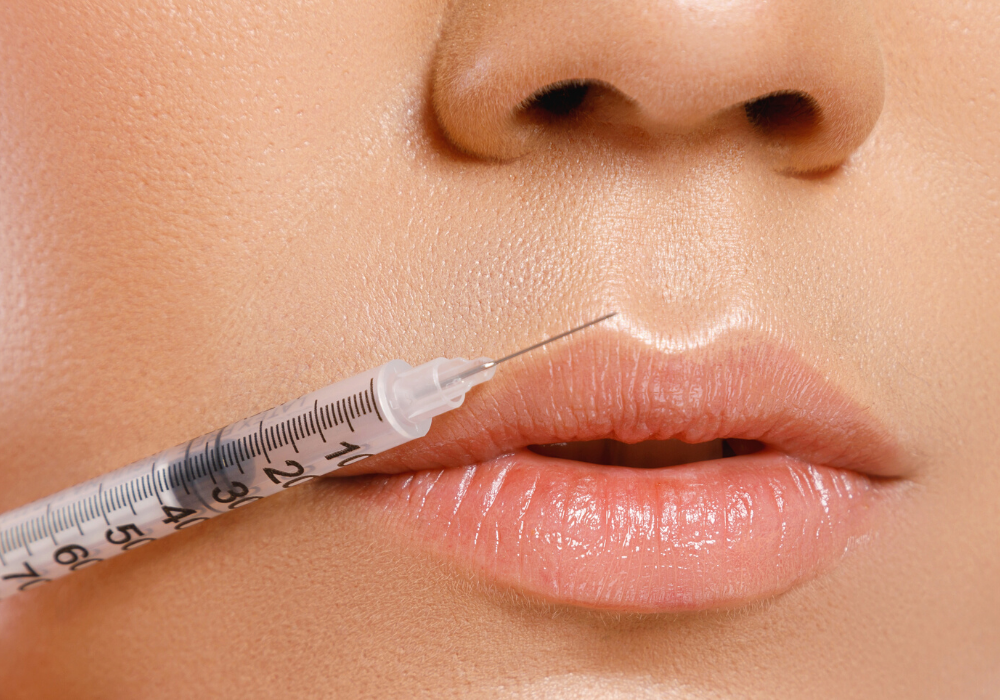 Best Lip Injections Dermal Fillers Mclean Cosmetic Dermatology Center 