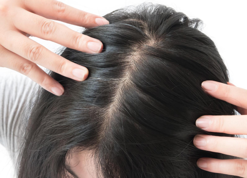 PRP for Hair Loss | Does it Really Work? | Cosmetic Dermatology Center