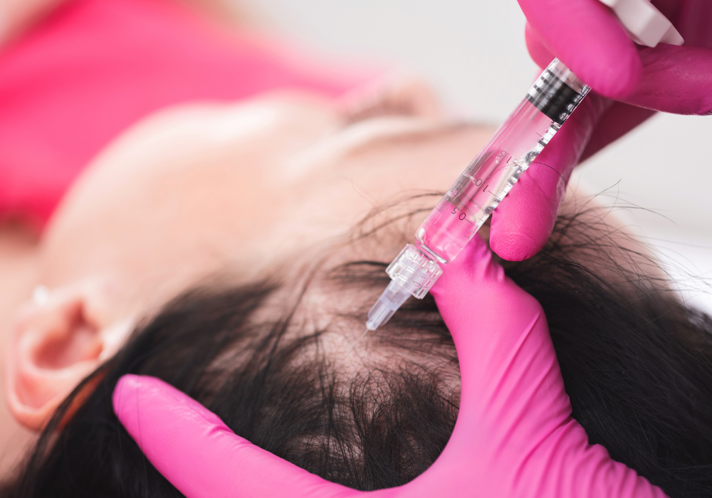 PRP for hair loss near me