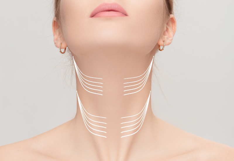 best non-surgical neck lift mclean