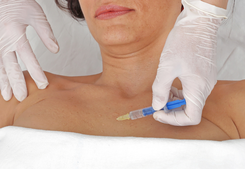 Using Wrinkle reduction treatment and Fillers for Chest and