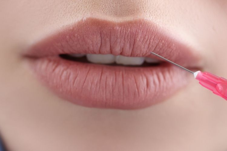 https://cosmetic-dermatology-center.com/wp-content/uploads/2022/02/lip-filler-vienna-va.jpg