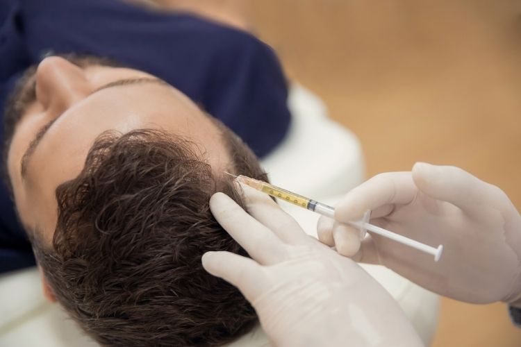 prp mclean for hair restoration