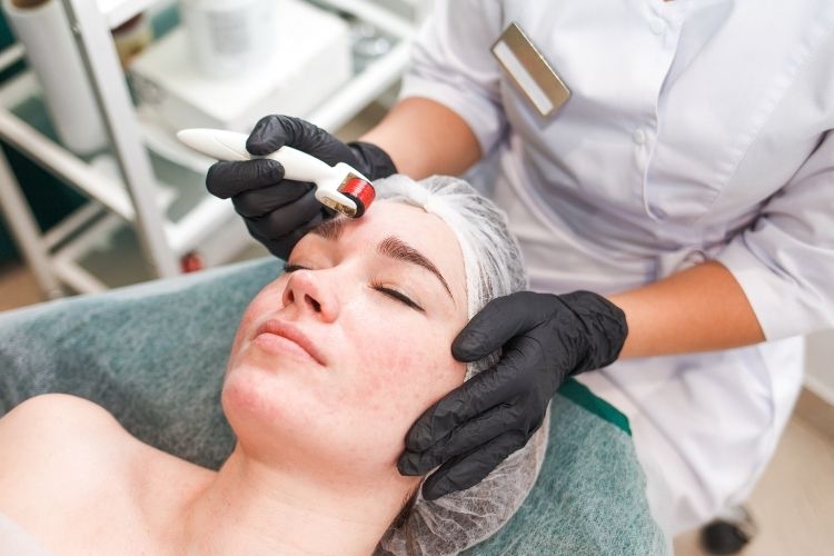 microneedling with prp northern virginia