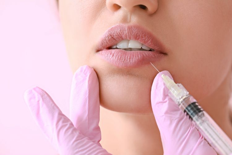 minimize lip filler bruising