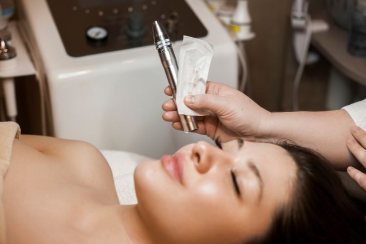 microneedling with prp tysons corner